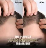 Hair Growth Oil & Derma Roller Pack