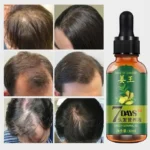 Hair Growth Oil & Derma Roller Pack