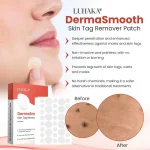 DermaSmooth Skin Tag Remover Patch – Fast, Safe, And Painless Skin Tag And Mole Removal Solution With No Scarring Or Pigmentation - Image 3