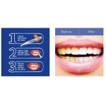 Dazzling White Instant Teeth Whitening Pen - Image 5