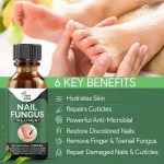Nail Fungus Treatment Gel Pakistan for smooth healthy-looking nails
