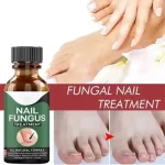 Nail Fungus Treatment Gel Pakistan for smooth healthy-looking nails