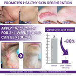 Timilk Regenscar Stem Cell Scar Gel 20g Triple Action Formula For Old And New Scars Surgical Marks Skin Renewal - Image 3