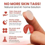 DermaSmooth Skin Tag Remover Patch – Fast, Safe, And Painless Skin Tag And Mole Removal Solution With No Scarring Or Pigmentation - Image 5